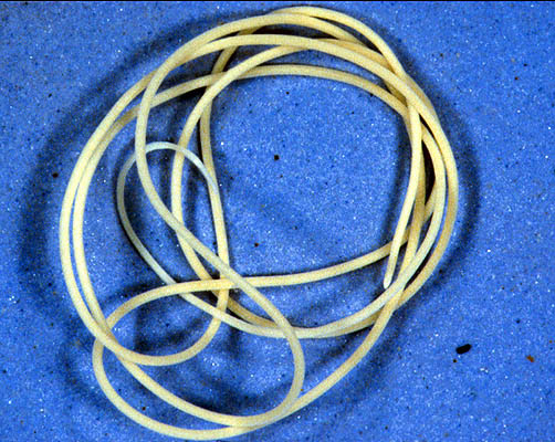 Horsehair Worm - Nematomorpha